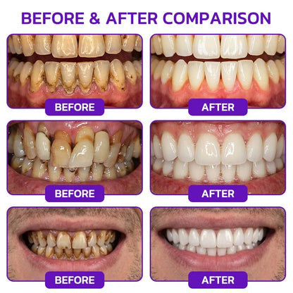 🦷VioCore Bee Venom Gingivitis & Periodontitis Treatment Toothpaste