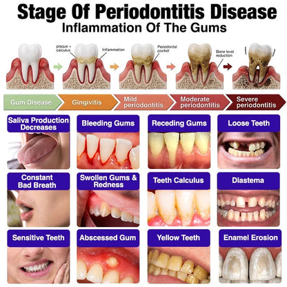 🦷VioCore Bee Venom Gingivitis & Periodontitis Treatment Toothpaste