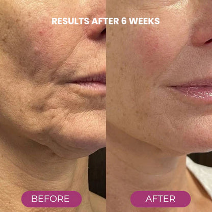 🔥LAST DAY 50% OFF!!✨ Buy More, Save More｜Smooth, Firm & Glow with Petluxecos Multi Balm 💜