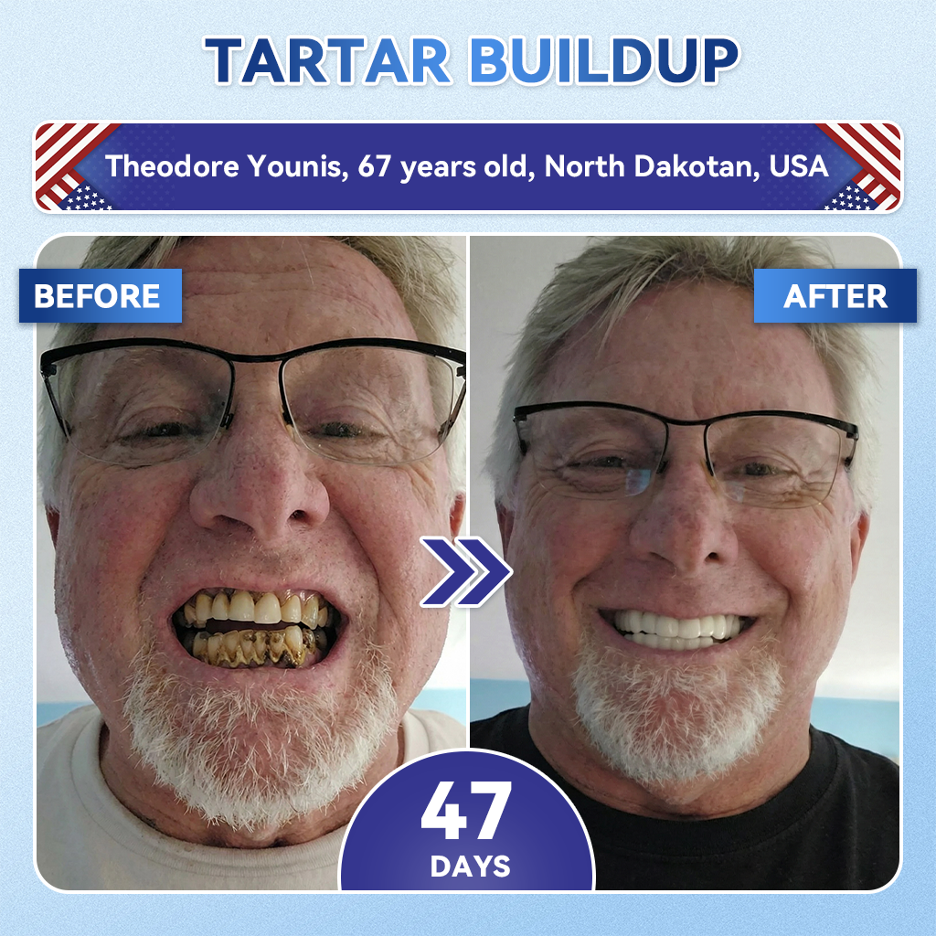 Dewvely® 🦷 Tideglusib Fast‑Dissolving Tooth & Gum Repair Oral Strips ✨
