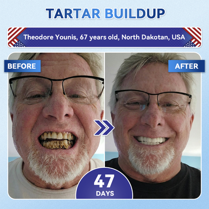Dewvely® 🦷 Tideglusib Fast‑Dissolving Tooth & Gum Repair Oral Strips ✨