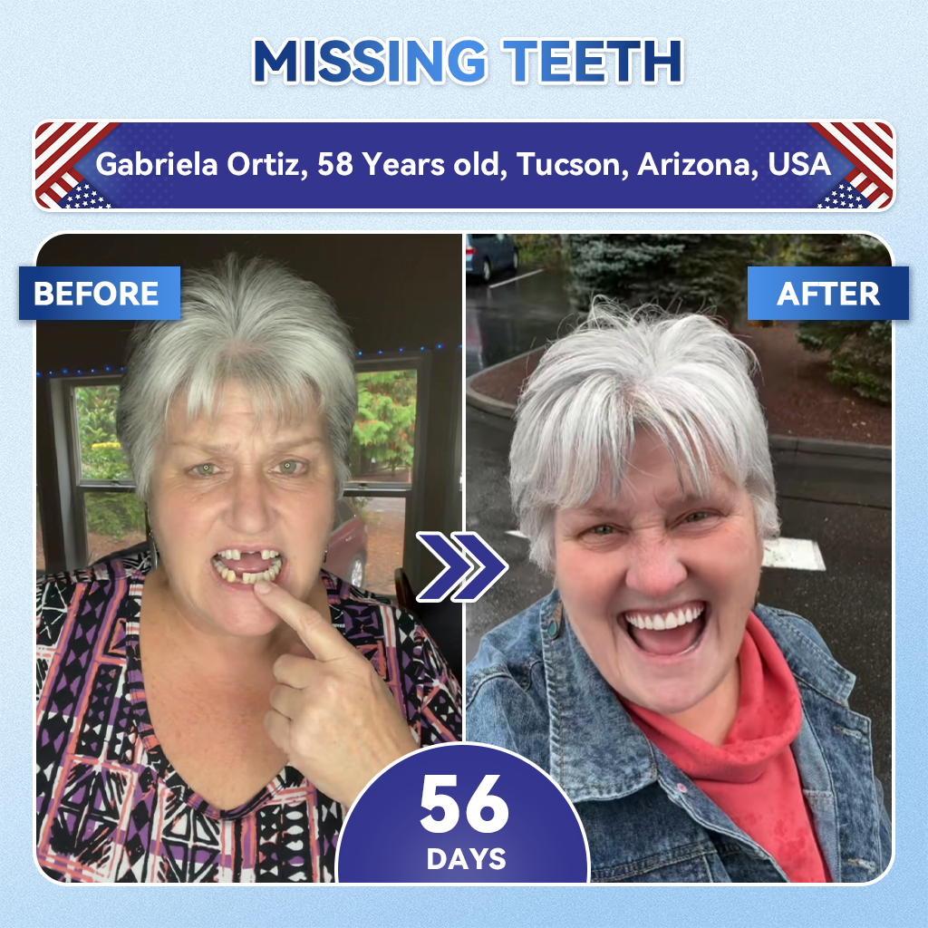 Dewvely® 🦷 Tideglusib Fast‑Dissolving Tooth & Gum Repair Oral Strips ✨