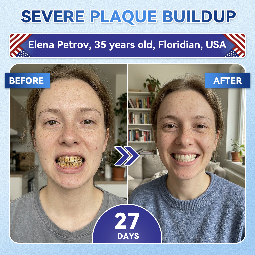 Dewvely® 🦷 Tideglusib Fast‑Dissolving Tooth & Gum Repair Oral Strips ✨