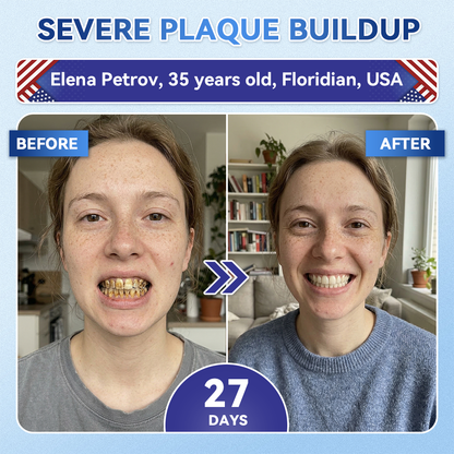 Dewvely® 🦷 Tideglusib Fast‑Dissolving Tooth & Gum Repair Oral Strips ✨