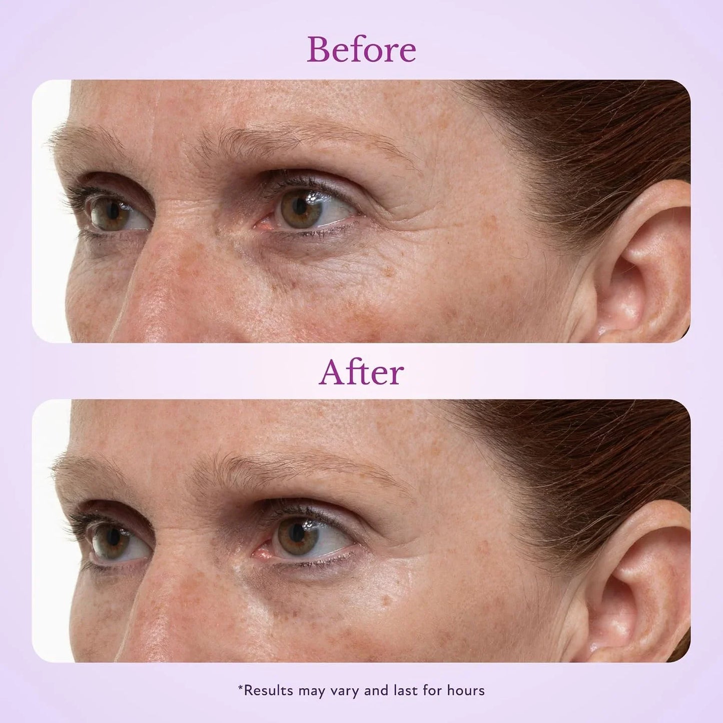 Fempick 60 Second Effects Tinted Firming Gel - Under Eye Cream For Puffiness And Bags Under Eyes