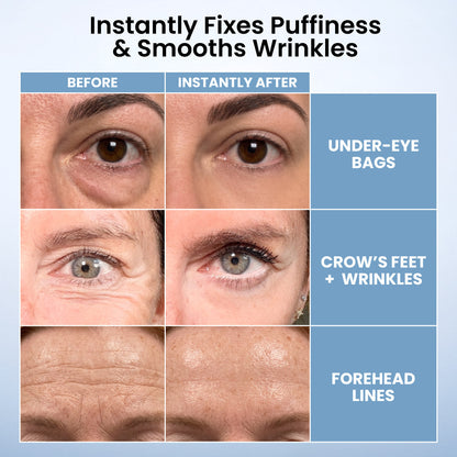 🌸 Instant Eye Tightener – New Formula, Ultimate Lift & Smooth Finish ✨
