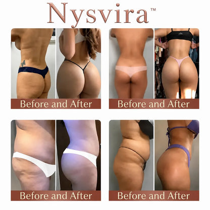 💥Selling out soon🔥-  CurveSculpt Micro-Patch ✦ Sculpt • Firm • Smooth Lower Body Curves ✦ Micro-Needle Infusion System