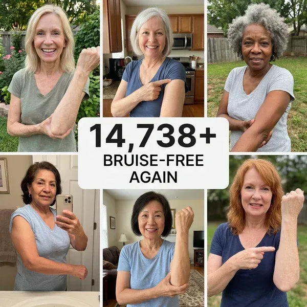 💥100K+ SOLD💕- Nysvira™ Bruise Repair & Skin-Strengthening Cream
