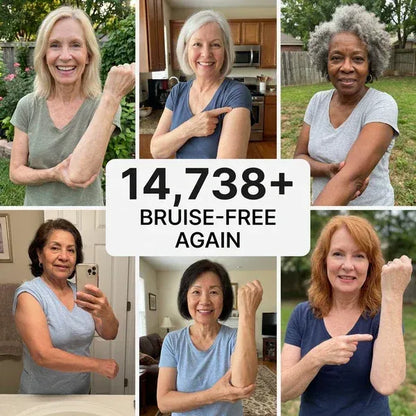💥100K+ SOLD💕- Nysvira™ Bruise Repair & Skin-Strengthening Cream