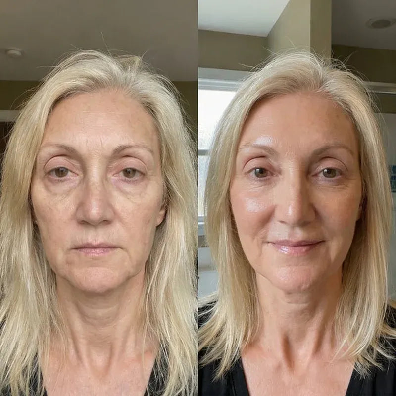 Age Reverse Cream - Lift & Repair Formula