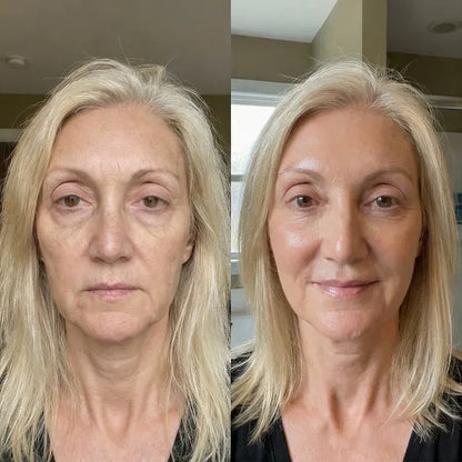 Age Reverse Cream - Lift & Repair Formula