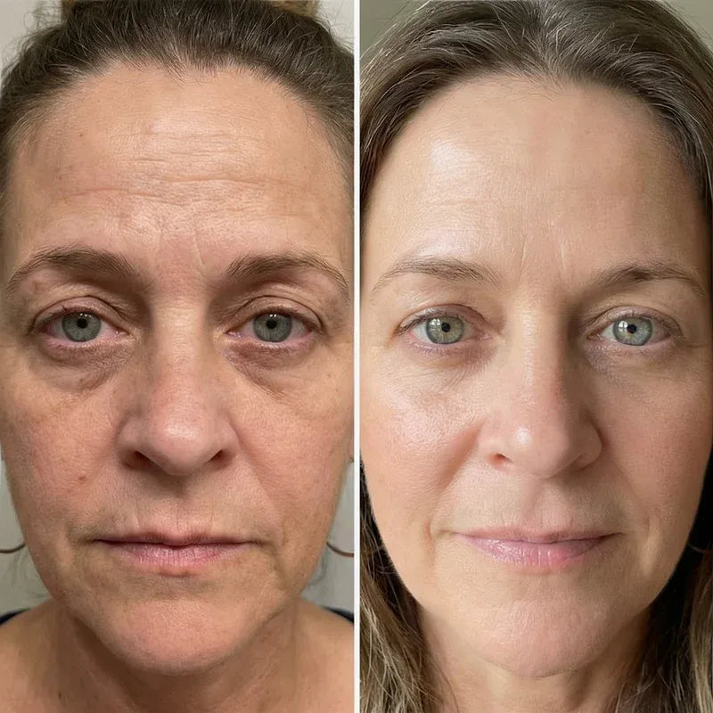 Age Reverse Cream - Lift & Repair Formula
