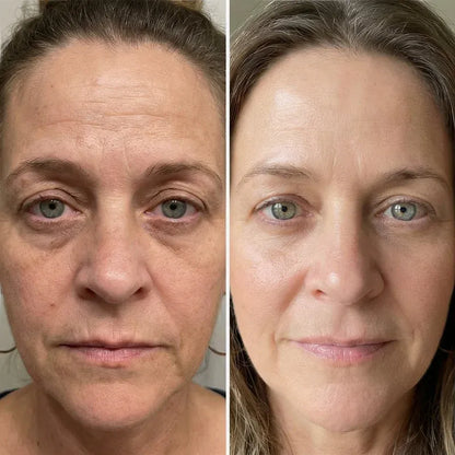 Age Reverse Cream - Lift & Repair Formula